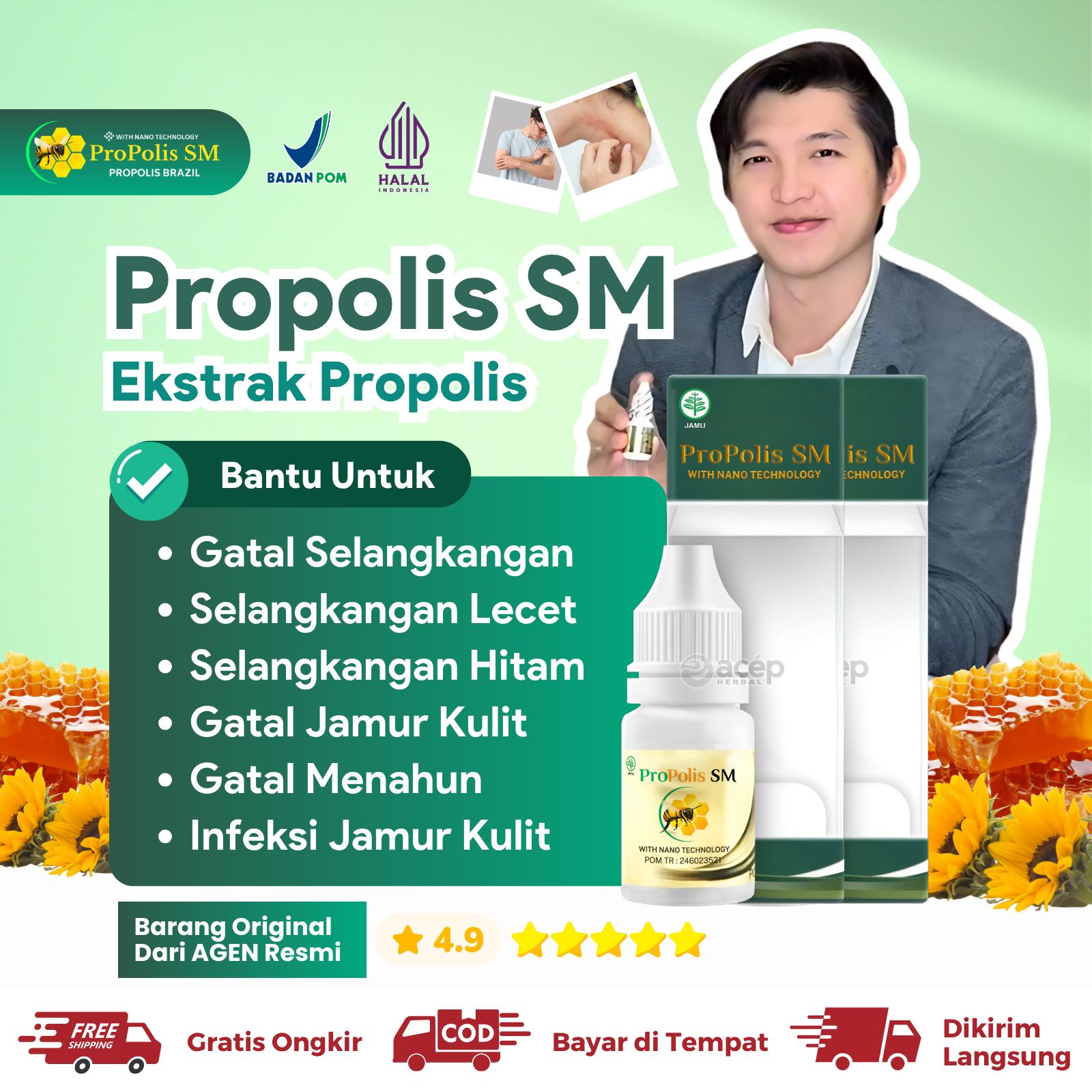 Propolis Sm Untuk Oles Gatal Selangkangan Hitam Kemaluan Pria Karena Jamur Masalah Kulit Kurap Panu Exsim exim Menahun Kering Basah Biduran Propolis Kerutan Mengencangkan Pelembab